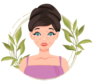 Acne Prone Skin